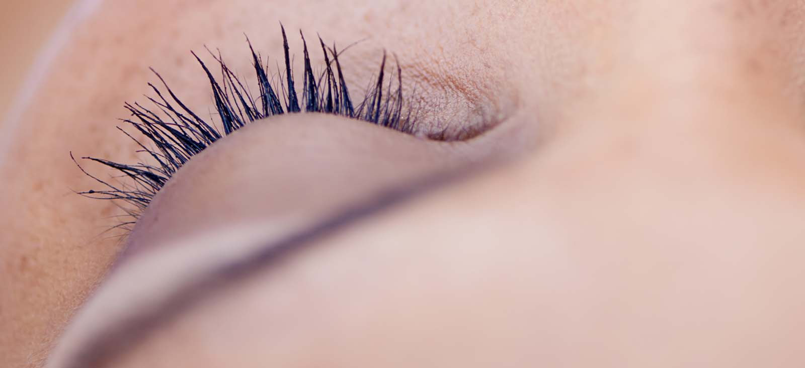 Eyelid Surgery 